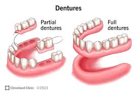 Complete and partial Dentures
